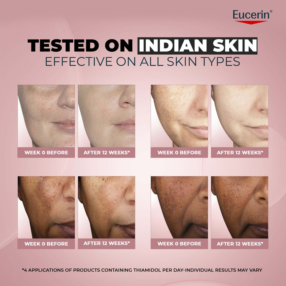 Eucerin Anti-Pigment Dual Serum With Thiamidol & Hyaluronic Acid , Reduces Dark Spots & Rejuvenates
(30ml)