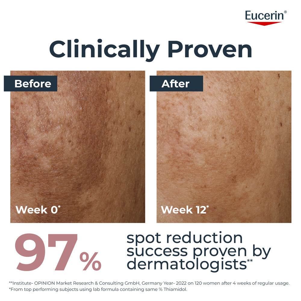 Eucerin Anti-Pigment Dual Serum With Thiamidol & Hyaluronic Acid , Reduces Dark Spots & Rejuvenates
(30ml)