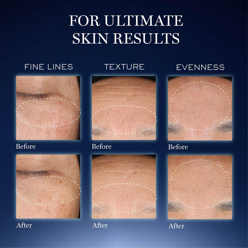 Lancome Advanced Genifique Ultimate Skin Repair Serum Starter Kit - For Radiant Healthy Skin
(8ml)