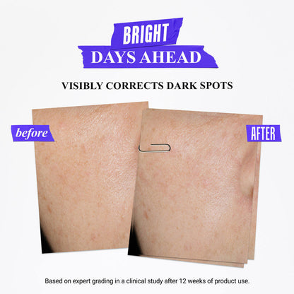 Kiehl's Clearly Corrective Dark Spot Solution With Activated C & Buffered Salicylic Acid
(50ml)