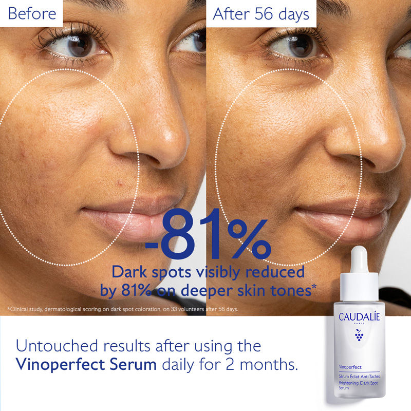Caudalie Vinoperfect Brightening Dark Spot Serum
(30ml)