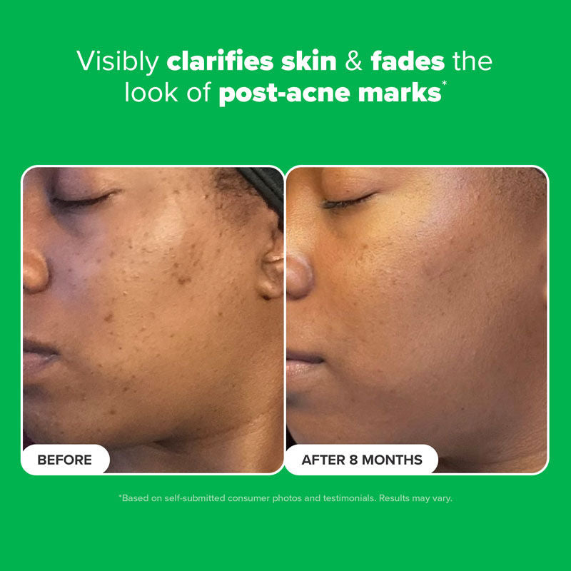 Paula's Choice Boost 10% Azelaic Acid Booster
(30ml)