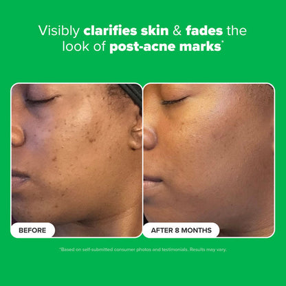 Paula's Choice Boost 10% Azelaic Acid Booster
(30ml)