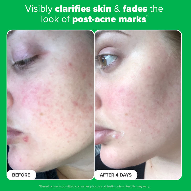 Paula's Choice Boost 10% Azelaic Acid Booster
(30ml)