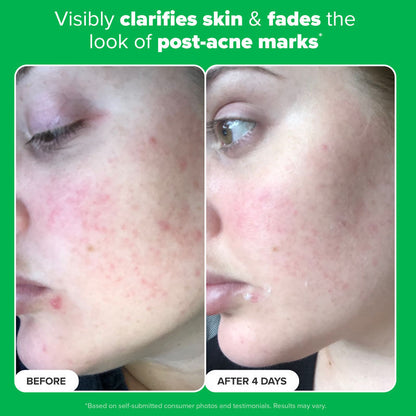 Paula's Choice Boost 10% Azelaic Acid Booster
(30ml)