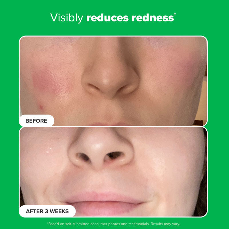 Paula's Choice Boost 10% Azelaic Acid Booster
(30ml)
