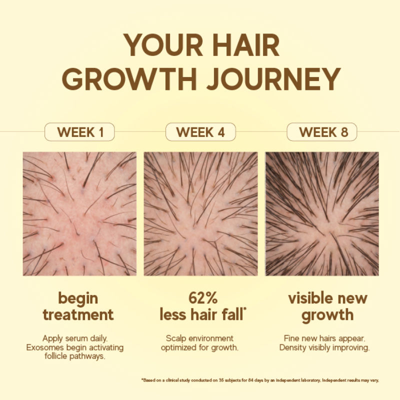 Moonlight Growth Scalp Serum for Hair Growth and Hairfall control
(50ml)