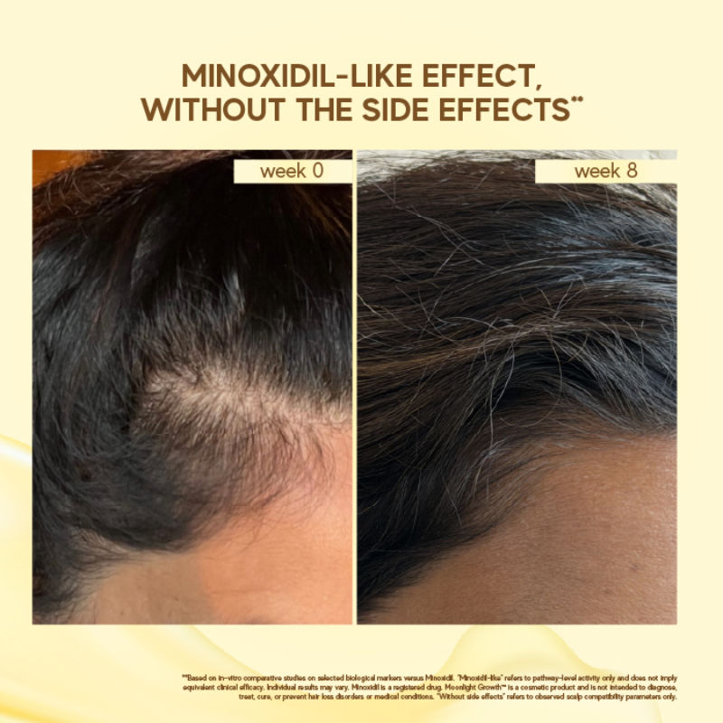 Moonlight Growth Scalp Serum for Hair Growth and Hairfall control
(50ml)