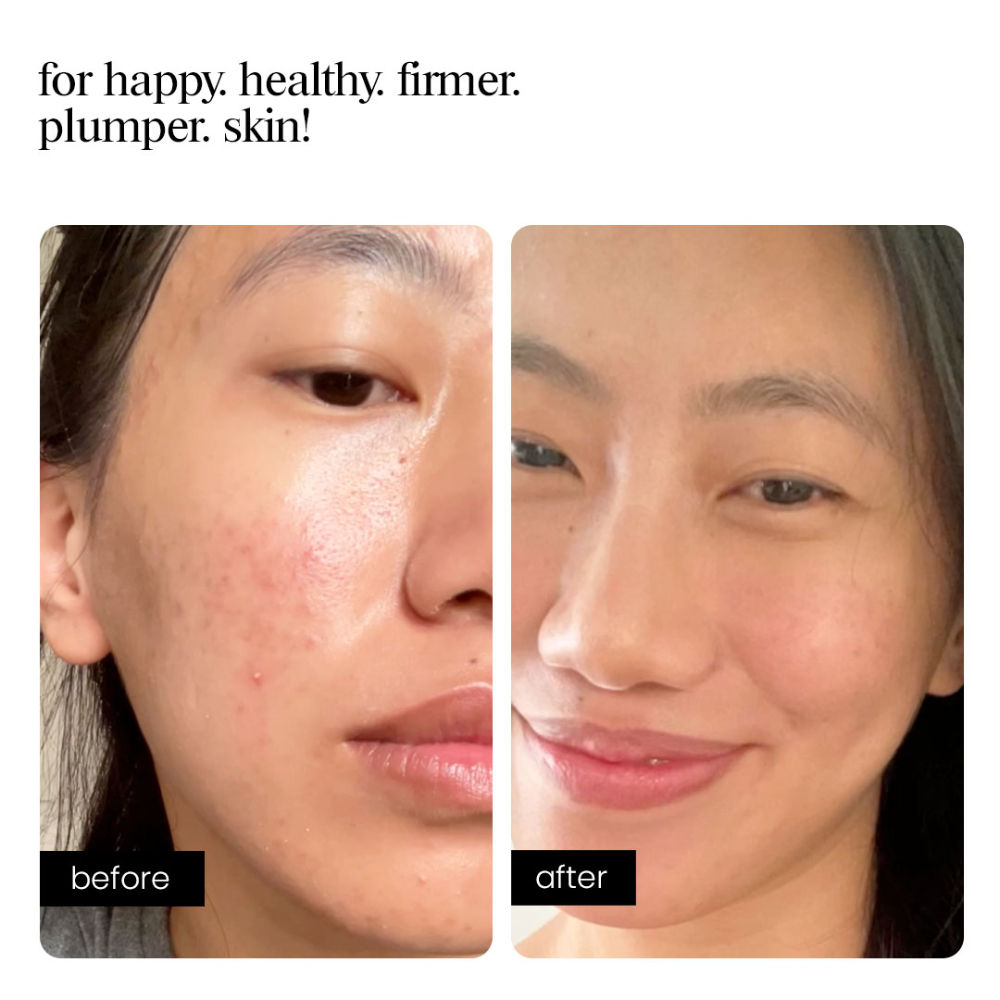 Copper Peptide Serum for Collagen Boost, Hydration, Firmness & Barrier Repair – DGA + Ectoin
(10ml)