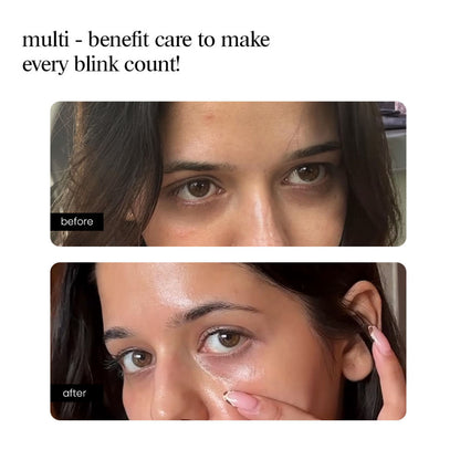 Eye Serum – Peptide, Caffeine, HA + 15 Actives for Dark Circles, Puffiness, Wrinkles, Fine Lines
(10ml)