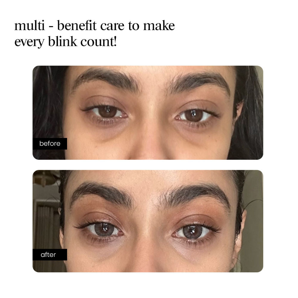 Eye Serum – Peptide, Caffeine, HA + 15 Actives for Dark Circles, Puffiness, Wrinkles, Fine Lines
(10ml)