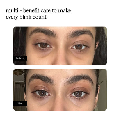 Eye Serum – Peptide, Caffeine, HA + 15 Actives for Dark Circles, Puffiness, Wrinkles, Fine Lines
(10ml)