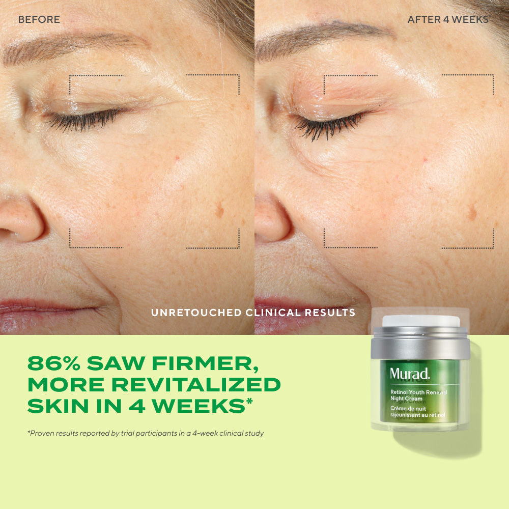 Murad Retinol Youth Renewal Night Cream
(50ml)