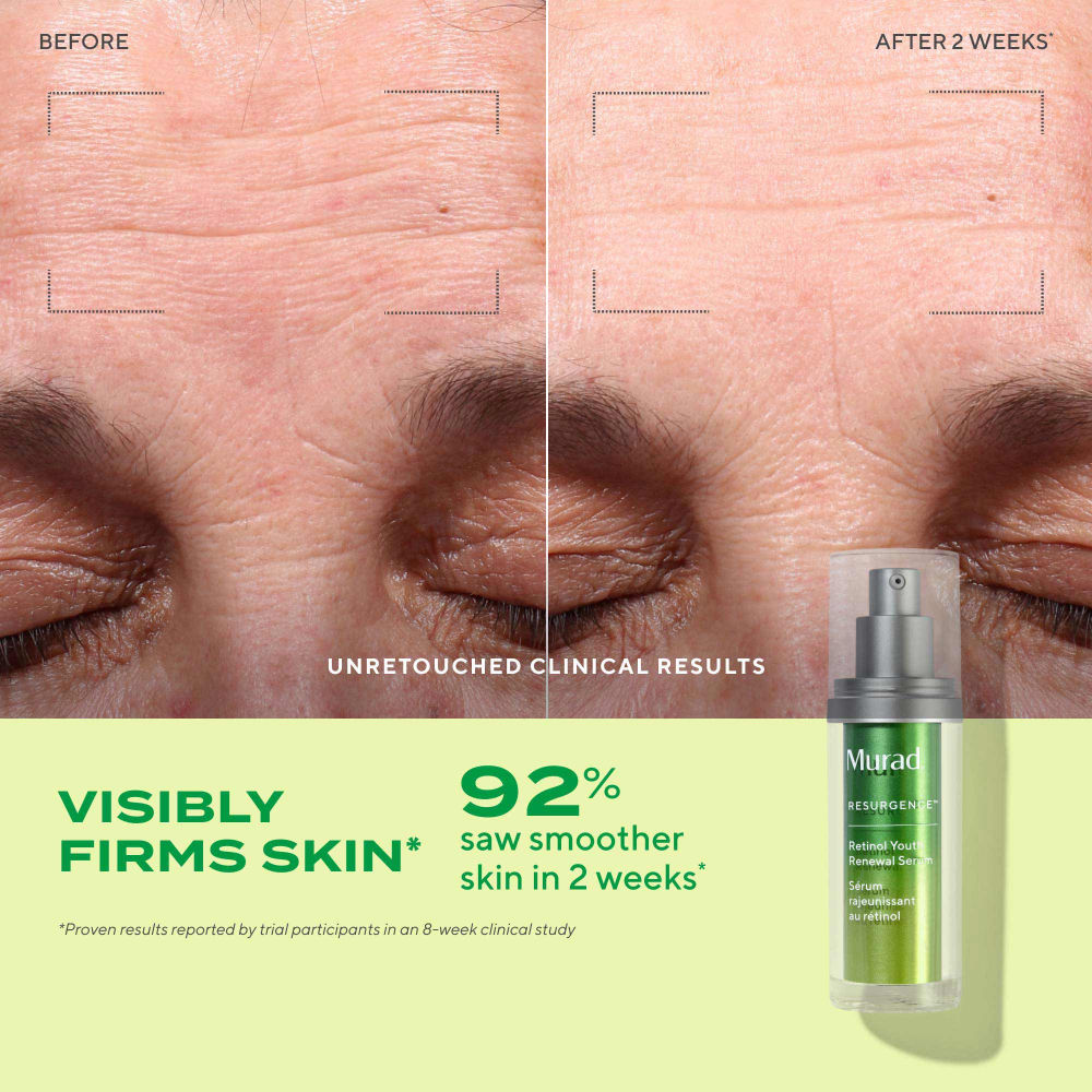 Murad Retinol Youth Renewal Serum
(30ml)