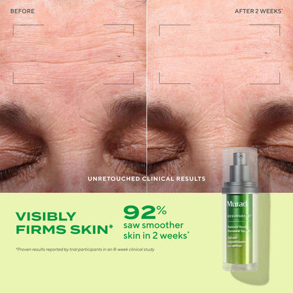 Murad Retinol Youth Renewal Serum
(30ml)